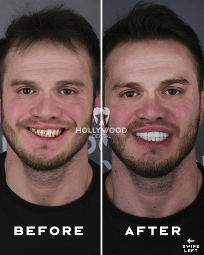 Slider image (1) Hollywood Dental Izmir Turkey